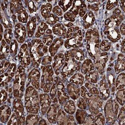 Immunohistochemistry: WDR34 Antibody [NBP1-88806]