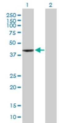 Western Blot: WDR34 Antibody [H00089891-B01P]