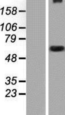 Western Blot: WDR34 Overexpression Lysate [NBP2-05859]