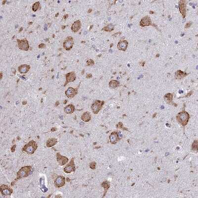 Immunohistochemistry-Paraffin: WDR35 Antibody [NBP1-92581]