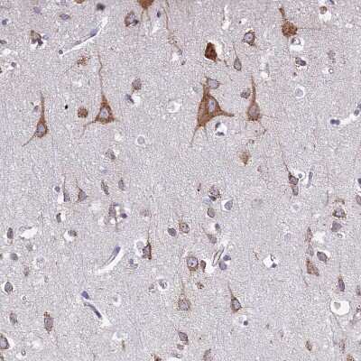 Immunohistochemistry-Paraffin: WDR35 Antibody [NBP1-92581]