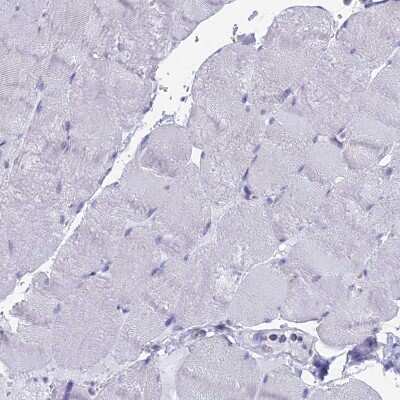 Immunohistochemistry-Paraffin: WDR35 Antibody [NBP1-92581]