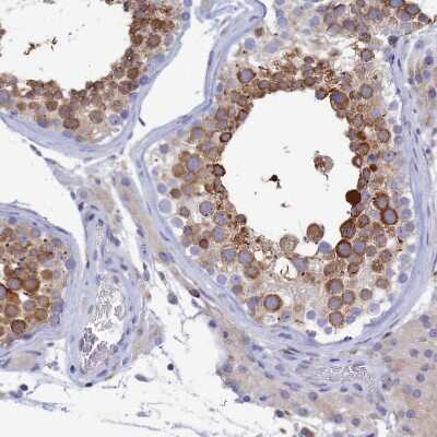 Immunohistochemistry-Paraffin: WDR35 Antibody [NBP1-92581]