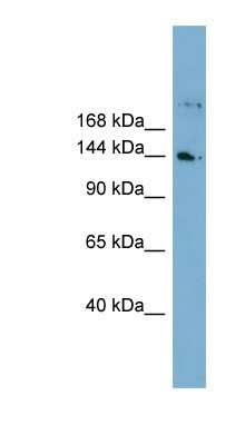 Western Blot: WDR35 Antibody [NBP1-70744]