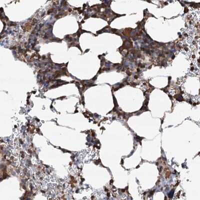 Immunohistochemistry: WDR36 Antibody [NBP2-38364]