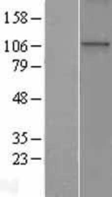 Western Blot: WDR36 Overexpression Lysate [NBP2-05576]