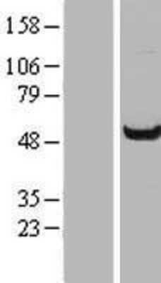 Western Blot: WDR37 Overexpression Lysate [NBP2-07391]