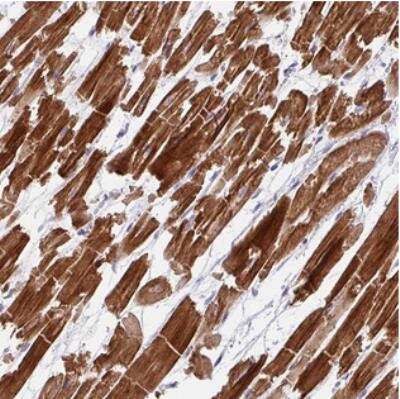 Immunohistochemistry: WDR38 Antibody [NBP2-30958]