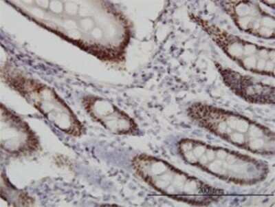 Immunohistochemistry-Paraffin: WDR4 Antibody (1F9) [H00010785-M01]
