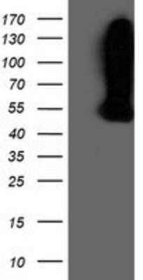 Western Blot: WDR4 Antibody (OTI4G1) [NBP2-01409]