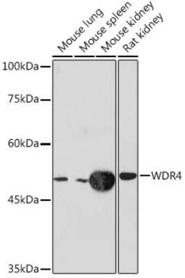 Western Blot: WDR4 Antibody (5R7B6) [NBP3-15902]