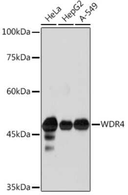 Western Blot: WDR4 Antibody (5R7B6) [NBP3-15902]