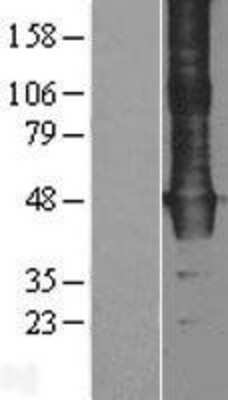 Western Blot: WDR4 Overexpression Lysate [NBL1-17803]