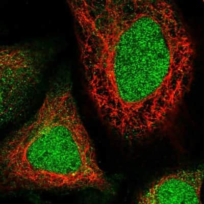 Immunocytochemistry/ Immunofluorescence: WDR41 Antibody [NBP1-83812]