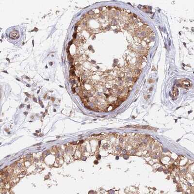 Immunohistochemistry-Paraffin: WDR41 Antibody [NBP1-83812]