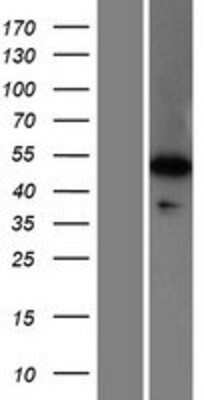 Western Blot: WDR41 Overexpression Lysate [NBP2-06833]