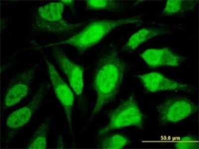 Immunocytochemistry/ Immunofluorescence: WDR42A Antibody (4G8) [H00050717-M10]