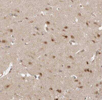 Immunohistochemistry-Paraffin: WDR42A Antibody [NBP1-92582]