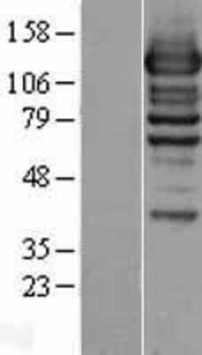 Western Blot: WDR44 Overexpression Lysate [NBL1-17809]