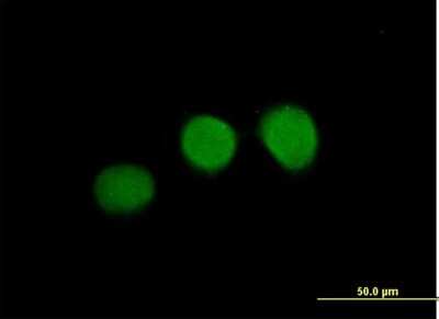 Immunocytochemistry/ Immunofluorescence: WDR45 Antibody [H00011152-B01P]