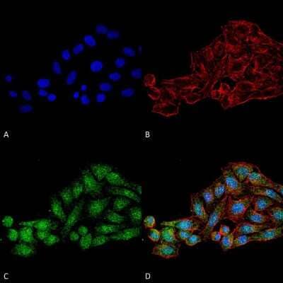 Immunocytochemistry/ Immunofluorescence: WDR45 Antibody [NBP3-18255]