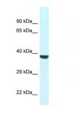 Western Blot: WDR45L Antibody [NBP1-82387]