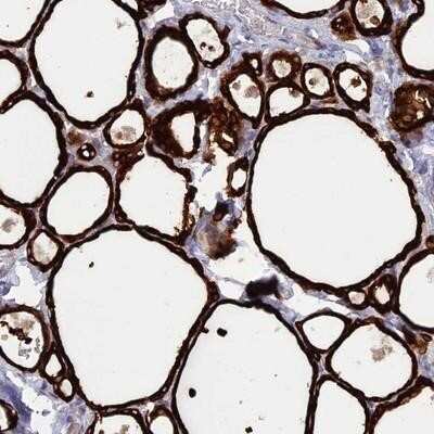 Immunohistochemistry-Paraffin: WDR46 Antibody [NBP1-94128]