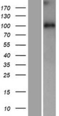 Western Blot: WDR47 Overexpression Lysate [NBP2-07233]