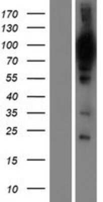 Western Blot: UAF1/WDR48 Overexpression Lysate [NBP2-06599]