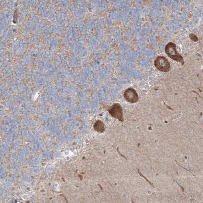 Immunohistochemistry: WDR49 Antibody [NBP2-48654]