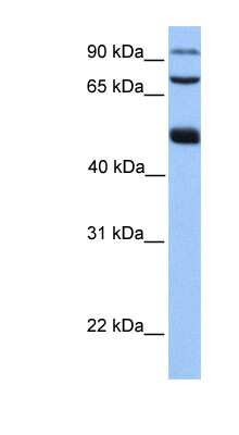 Western Blot: WDR49 Antibody [NBP1-70745]