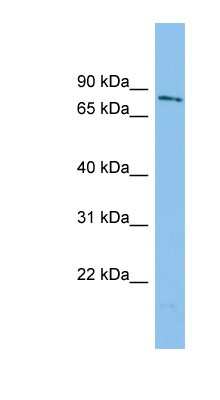 Western Blot: WDR49 Antibody [NBP1-70746]