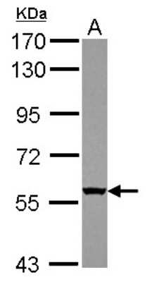 Western Blot: WDR49 Antibody [NBP2-20894]