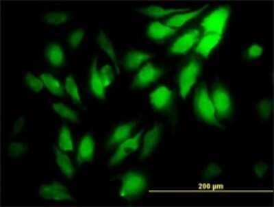 Immunocytochemistry/ Immunofluorescence: WDR5 Antibody (2C2) [H00011091-M01]