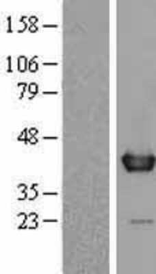 Western Blot: WDR5 Overexpression Lysate [NBL1-17816]