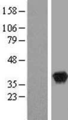 Western Blot: WDR5 Overexpression Lysate [NBL1-17817]