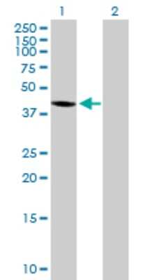 Western Blot: WDR51A Antibody [H00025886-B01P]