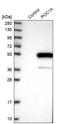 Western Blot: WDR51A Antibody [NBP1-88008]