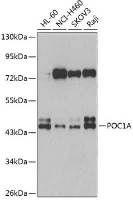 Western Blot: WDR51A AntibodyBSA Free [NBP2-93129]