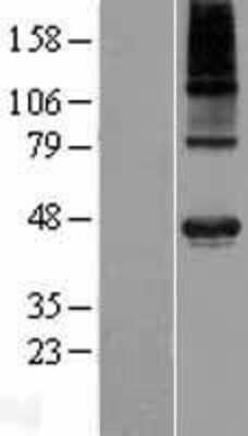 Western Blot: WDR51A Overexpression Lysate [NBP2-07180]