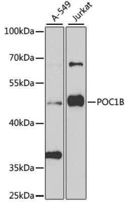 Western Blot: WDR51B AntibodyBSA Free [NBP2-93384]