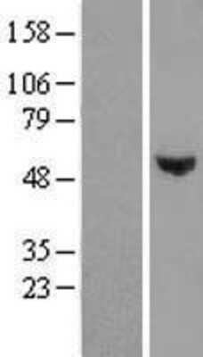 Western Blot: WDR51B Overexpression Lysate [NBL1-17818]