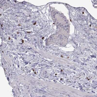 Immunohistochemistry: WDR52 Antibody [NBP2-38105]