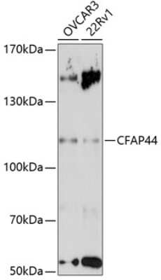 Western Blot: WDR52 AntibodyAzide and BSA Free [NBP2-93585]