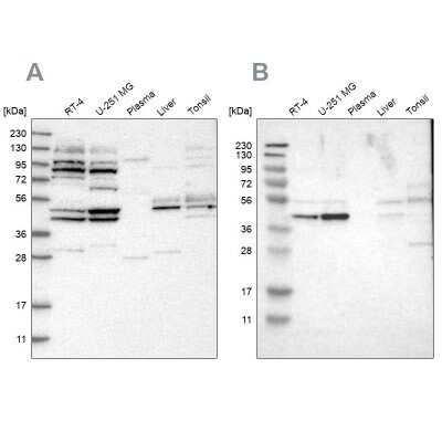 Western Blot: WDR53 Antibody [NBP1-82757]