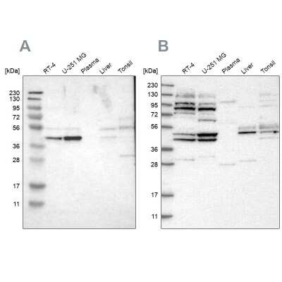 Western Blot: WDR53 Antibody [NBP1-82758]