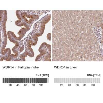 Immunohistochemistry-Paraffin: WDR54 Antibody [NBP1-82275]