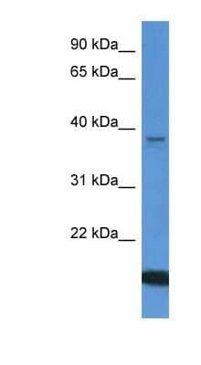 Western Blot: WDR54 Antibody [NBP1-79833]