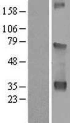 Western Blot: WDR54 Overexpression Lysate [NBL1-17819]