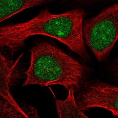 Immunocytochemistry/ Immunofluorescence: WDR55 Antibody [NBP2-30625]